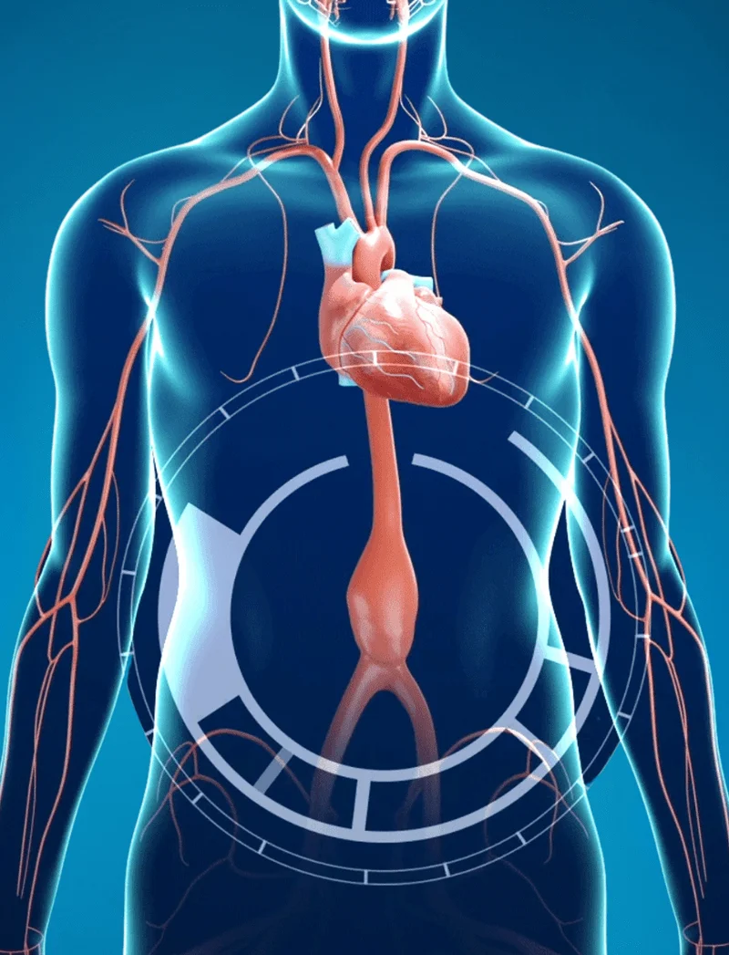 Aortic Interventions