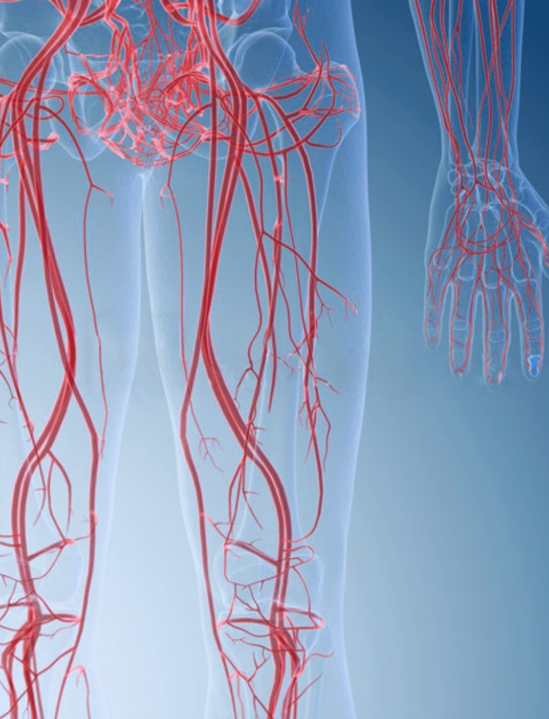 Peripheral Vascular Interventions (1)